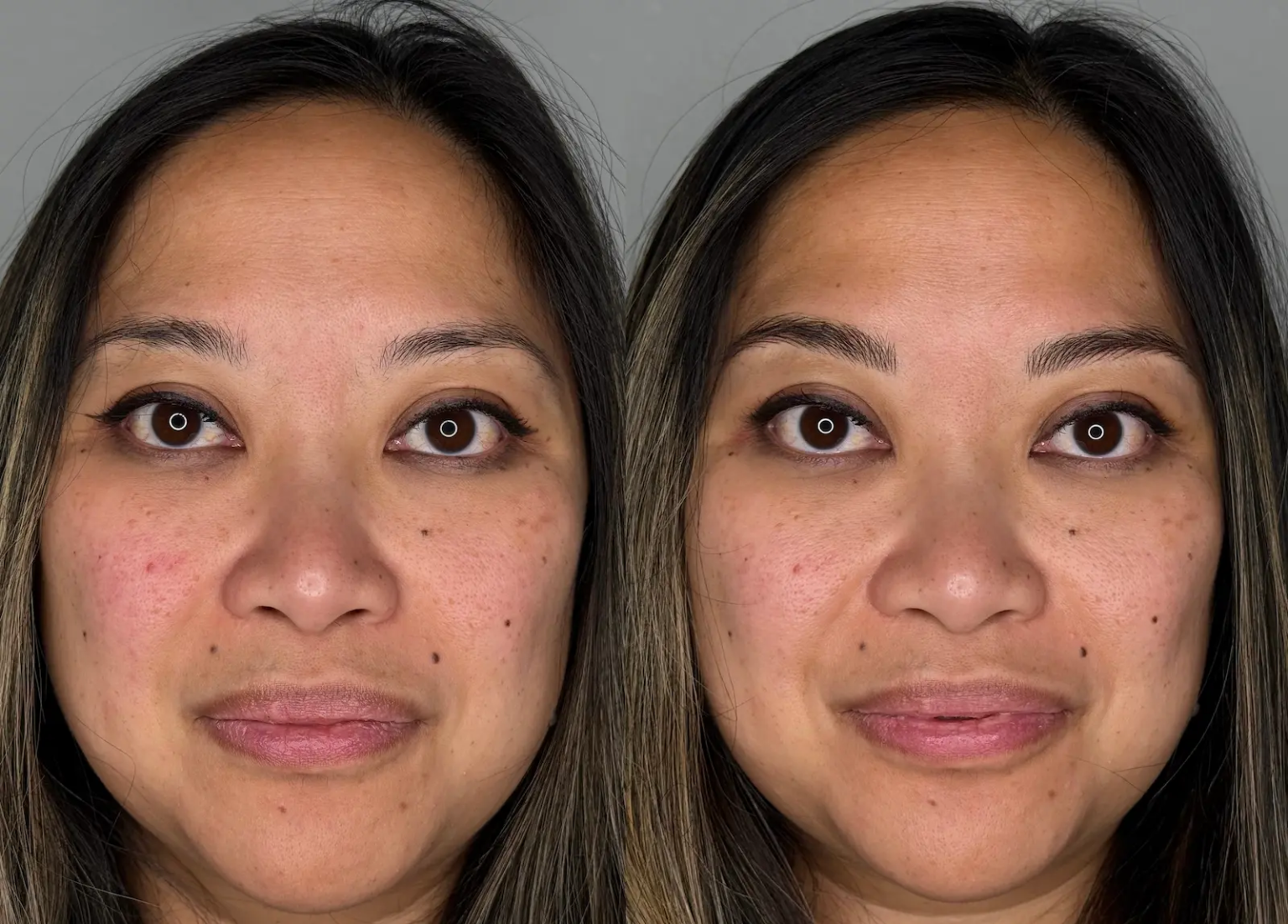 Natural hair-stroke eyebrow enhancement creating soft definition and balanced symmetry results in Sacramento.
