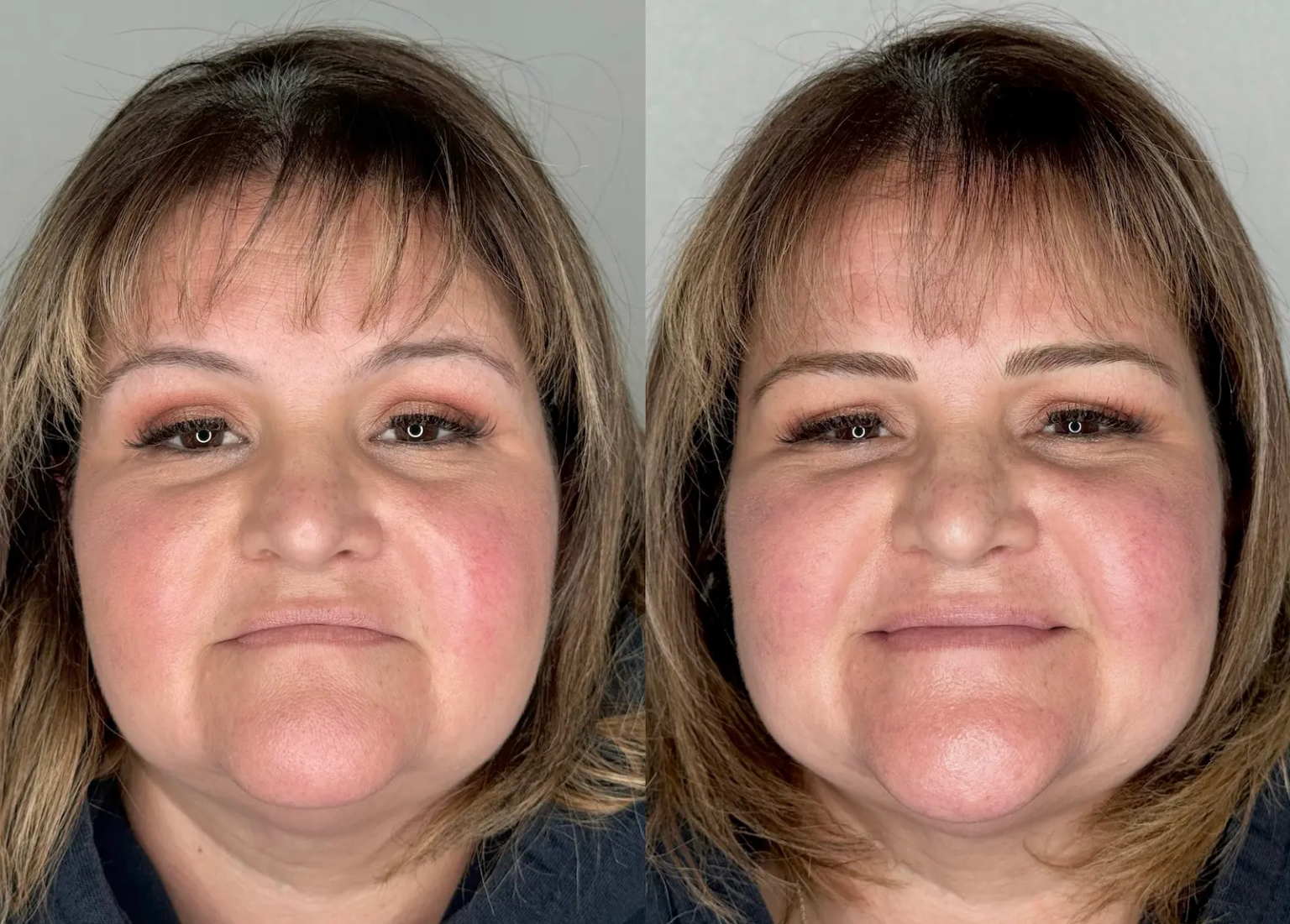 Nano hair-stroke eyebrow enhancement creating soft, natural-looking brows with refined shape and symmetry results in Sacramento.
