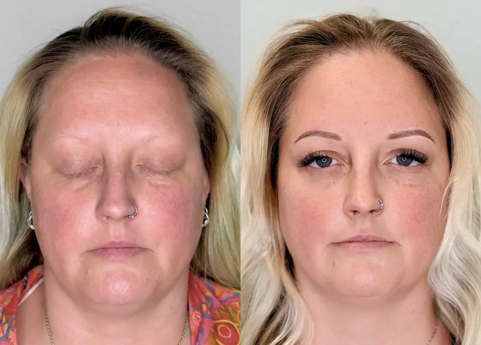Hair-stroke eyebrow enhancement creating fuller, natural-looking brows with improved symmetry results in Sacramento.